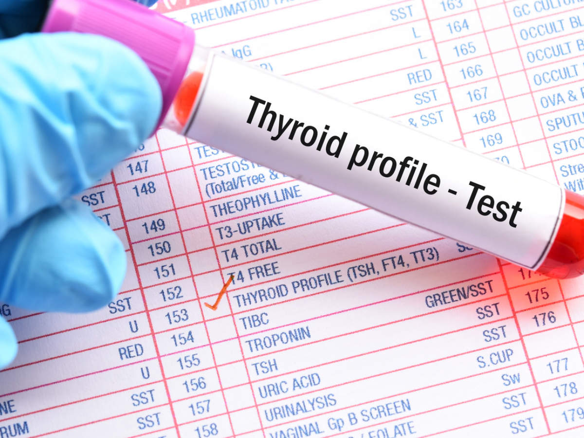 Thyroid Profile - I