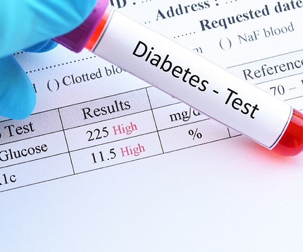 Diabetes Screen - I